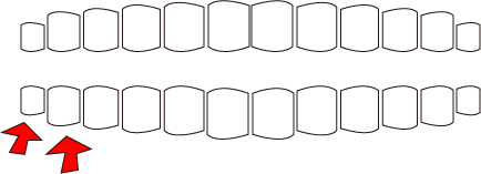 歯の悪いところ